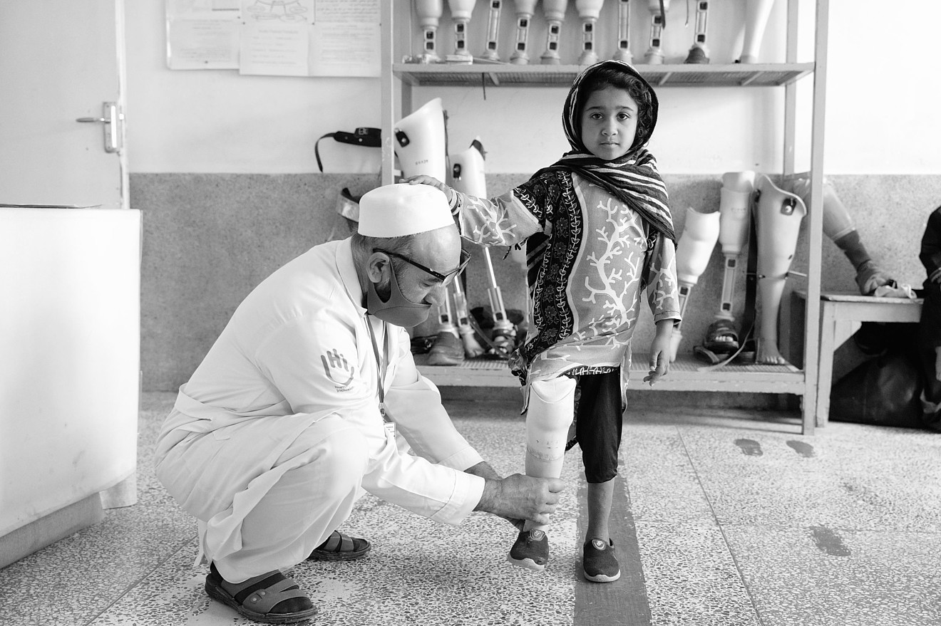 Amina steht auf einem Bein, ein Orthopäde kniet neben ihr und hält ihre Beinprothese.