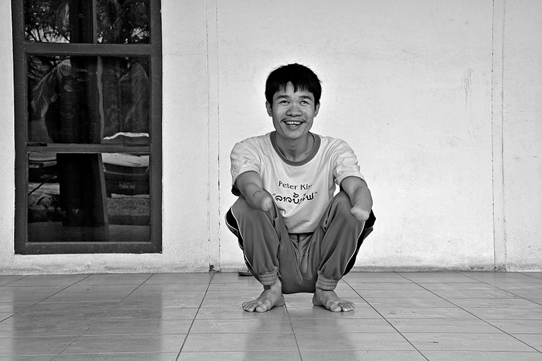 [Translate to Leichte Sprache:] Ein junger laotischer Mann mit kurzen dunklen Haaren sitzt in einem sterilen Raum in der Hocke. Seine Arme liegen locker auf den Knien, sie enden in Stümpfen. Leicht schielend lächelt er in die Kamera.